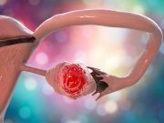 CA-125 Levels Vary by Patient Race at Ovarian Cancer Diagnosis