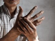 COPD Tied to Increased Risk for Death in Patients With Arthritis