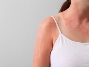 Many U.S. Adults Still Have Misconceptions About Skin Cancer Risk