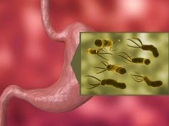 Lower Rates of Symptom Rebound Seen After H. Pylori Eradication in GERD