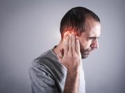 Incidence of RT-Induced Otitis Media With Effusion Examined in Head and Neck Cancer