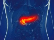 Disparities Evident in Treatment, Survival for Patients With Pancreatic Cancer