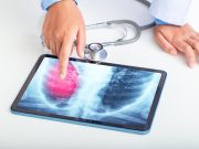 Lung Cancer Screening Rates Increased After 2021 Update to USPSTF Guidelines