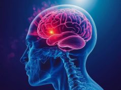 Age-Adjusted Ischemic Stroke Mortality Increased Since 2009