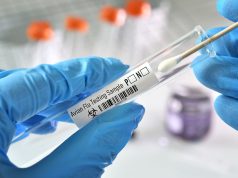 California Gives $25 Gift Cards to Boost Bird Flu Testing