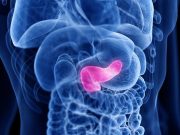 2000 to 2021 Saw Increase in Incidence of Pancreatic Adenocarcinoma
