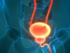 NeuroSAFE Improves Erectile Function After Radical Prostatectomy