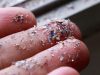 ACC: Microplastic Exposure Tied to Chronic Disease Prevalence