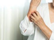 Global Burden of Atopic Dermatitis in Older Adults Is Considerable