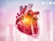 Replacing Sedentary Activity With Sleep, Exercise Beneficial in Acute Coronary Syndrome