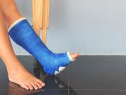 Preinjury Mobility Predicts Adults’ Recovery After Lower-Extremity Fracture