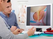 MRI-Guided Biopsy Linked to Durability of Active Surveillance in Prostate Cancer