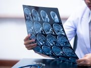 CT Perfusion and CT Angiography Not Useful as Standalone Tests for Establishing Death by Neurologic Criteria