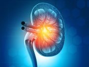 Standard-Criteria Kidney Transplant Offers Clear Survival Benefit Over Continued Dialysis