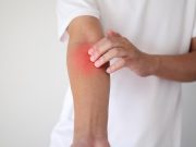 AI Model Can Aid Physicians in Skin Cancer Diagnoses