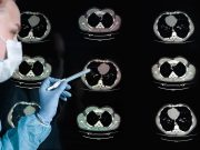 Generative AI Model for Draft Radiological Reporting Improves Documentation Efficiency