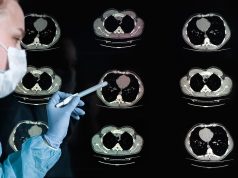 Generative AI Model for Draft Radiological Reporting Improves Documentation Efficiency