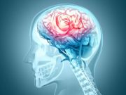 Longer In-Bed Time Linked to Small Vessel Disease Burden in TIA/Mild Stroke