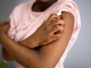 Psoriasis Tied to Increased Risk for Sleep Disorders