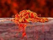 Presurgical Immunotherapy Offers Long-Term Benefit in Melanoma