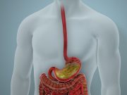 Capsule Sponge + Biomarkers Can Stratify Risk in Barrett Esophagus