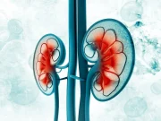 High Metabolic Syndrome Severity Linked to Development of CKD