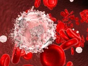 Leukemia & Lymphoma Society Changing Name to Blood Cancer United