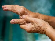 Benefits of Long-Term Routine Lab Drug Toxicity Monitoring Unclear in RA