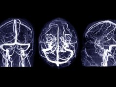 Prenatal Exposure to Pesticide Chlorpyrifos Linked to Brain Abnormalities