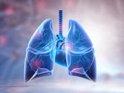 FDA Approves First Drug for Chronic Lung Condition Bronchiectasis