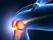 MRI Radiomics Plus Biomarker Model Can Predict Knee OA Progression