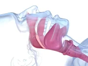 Blowing Conch Shell Tied to Improved Obstructive Sleep Apnea Measures