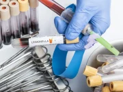 NYC Legionnaires’ Outbreak: Fourth Death Confirmed, 101 Sickened