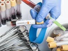 NYC Legionnaires’ Outbreak: Fourth Death Confirmed, 101 Sickened