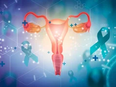 Missed Opportunity Common in Patients With High-Grade Serous Ovarian Cancer
