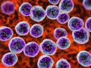 AI Models Can Help Predict In-Hospital Mortality in ICU Patients With Lymphoma