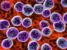 AI Models Can Help Predict In-Hospital Mortality in ICU Patients With Lymphoma