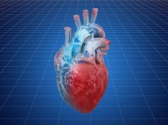 Use of AI Can Help Identify Coronary Thin-Cap Fibroatheromas