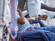 Guidance Issued for Creation of pAVFs for Hemodialysis Access