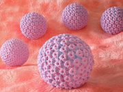 Deescalated Radiotherapy Tolerated After Surgery for HPV-Linked Oropharyngeal Cancer