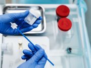 Nonadherence to Cervical Cancer Screening Increased After COVID-19 Pandemic