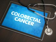 Providing Personalized Risk Messages  Has No Overall Effect on CRC Screening Uptake or Test Completion