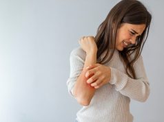 Suicidal Ideation Risk Elevated for Patients With Atopic Eczema