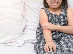 FDA Approves Opzelura for Atopic Dermatitis in Children