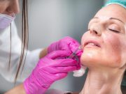 Hyaluronic Acid Fillers Restore Facial Volume, Fullness