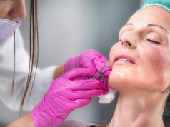 Hyaluronic Acid Fillers Restore Facial Volume, Fullness