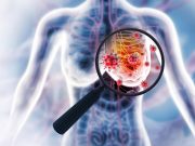 Polygenic Risk Score 313 Can Predict Risk for Breast Cancer After In Situ Disease