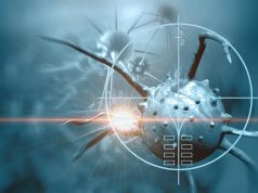 Macrovascular Infiltration May Predict Cancer Mortality