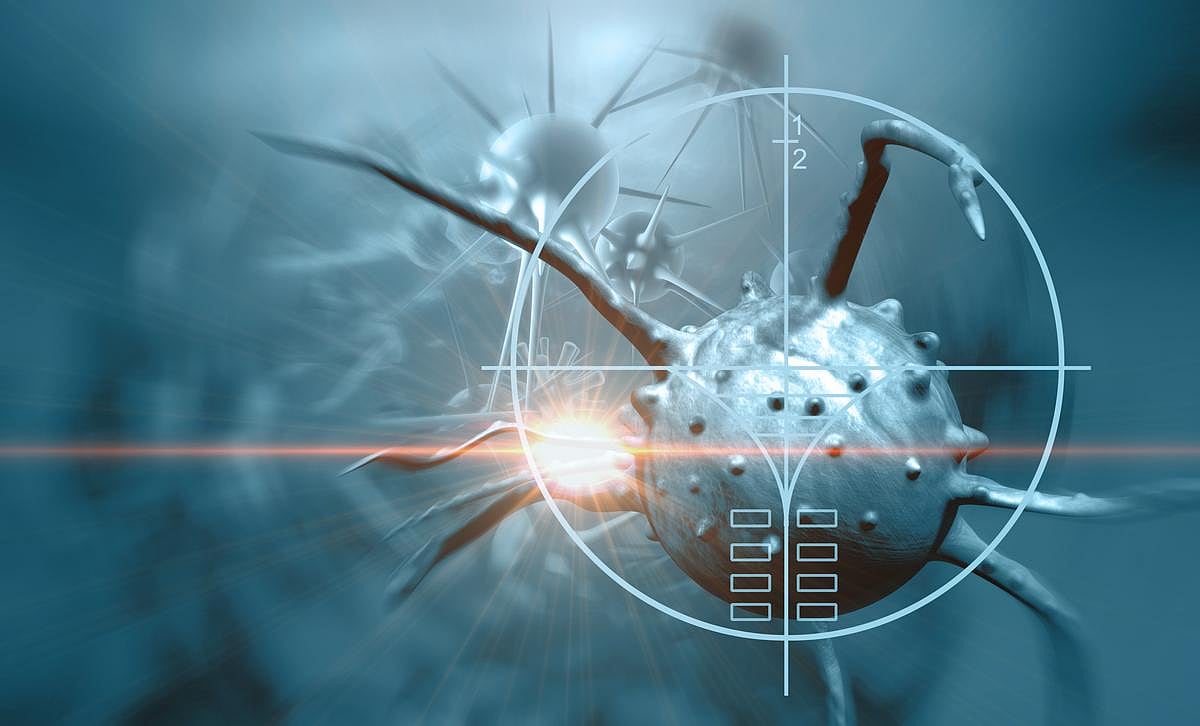 Macrovascular Infiltration May Predict Cancer Mortality