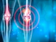 ASTRO: Low-Dose Radiation Improves Clinical Outcomes in Mild-to-Moderate Knee Osteoarthritis